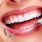 Cosmetic Dental Work Procedures